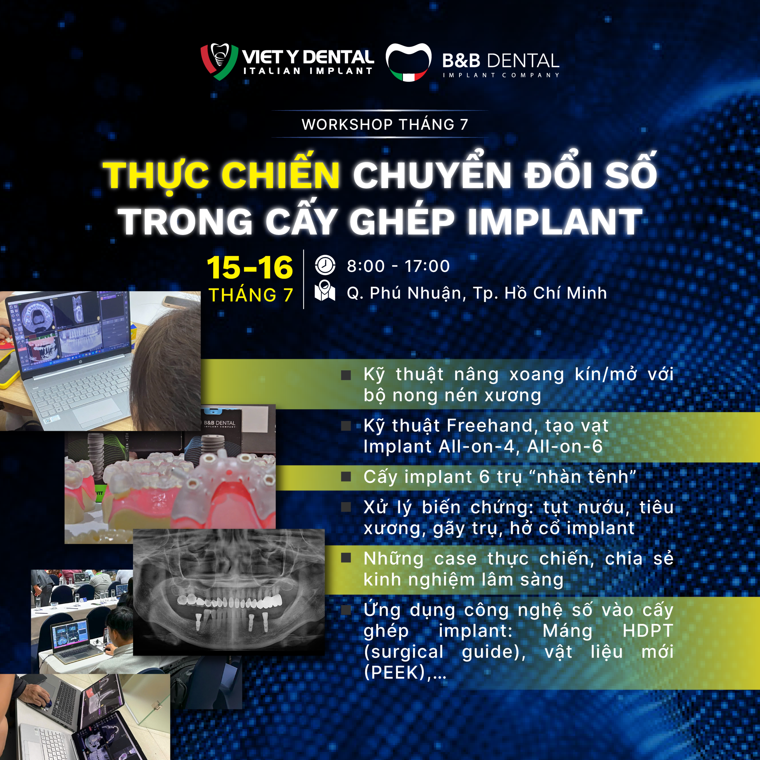 khoa hoc cetec việt ý dental