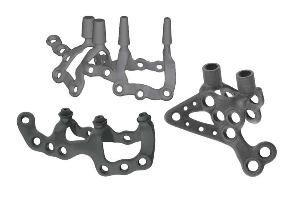 implant màng xương, implant iuxta, màng xương