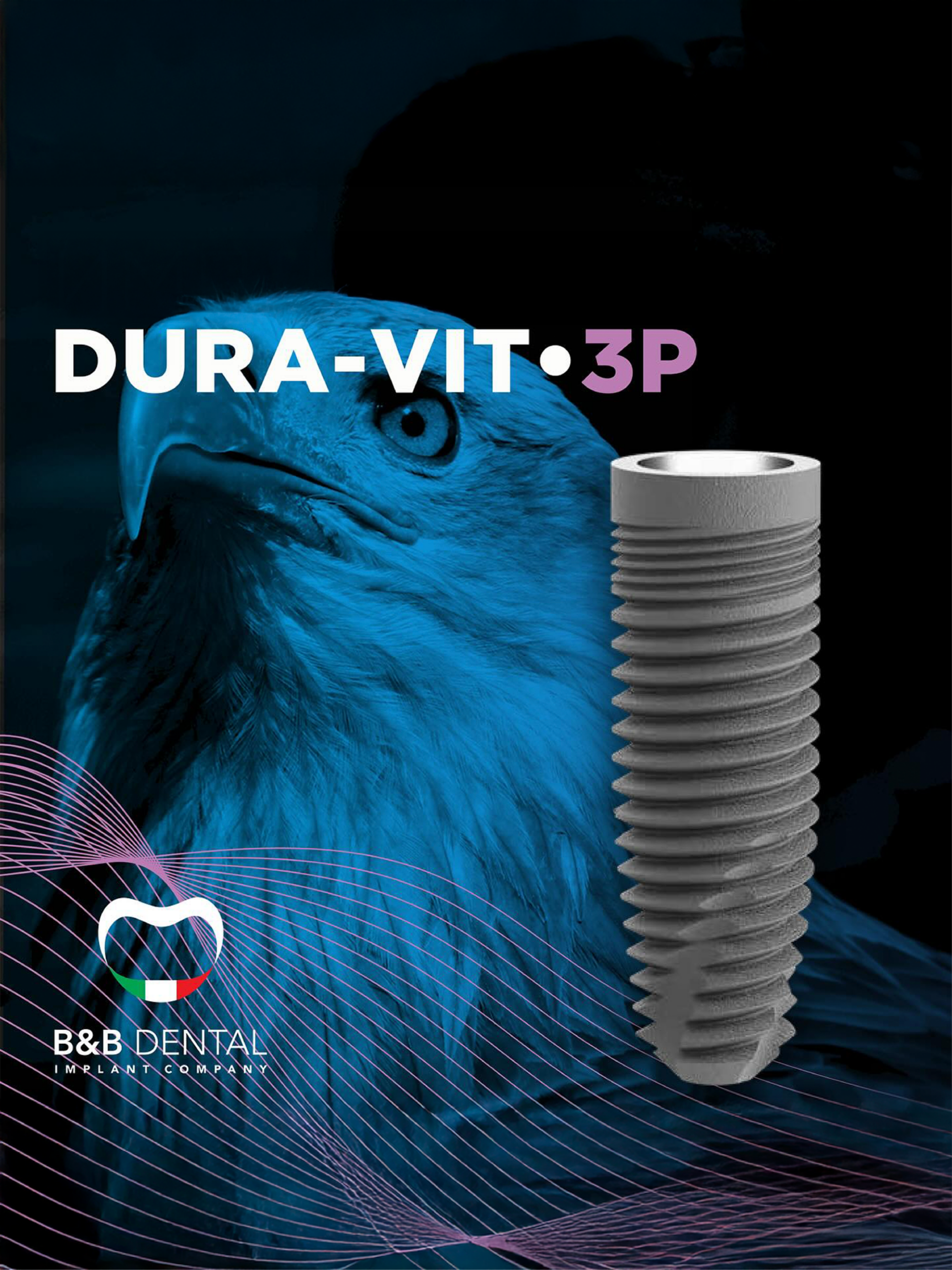 bnb implant 3P